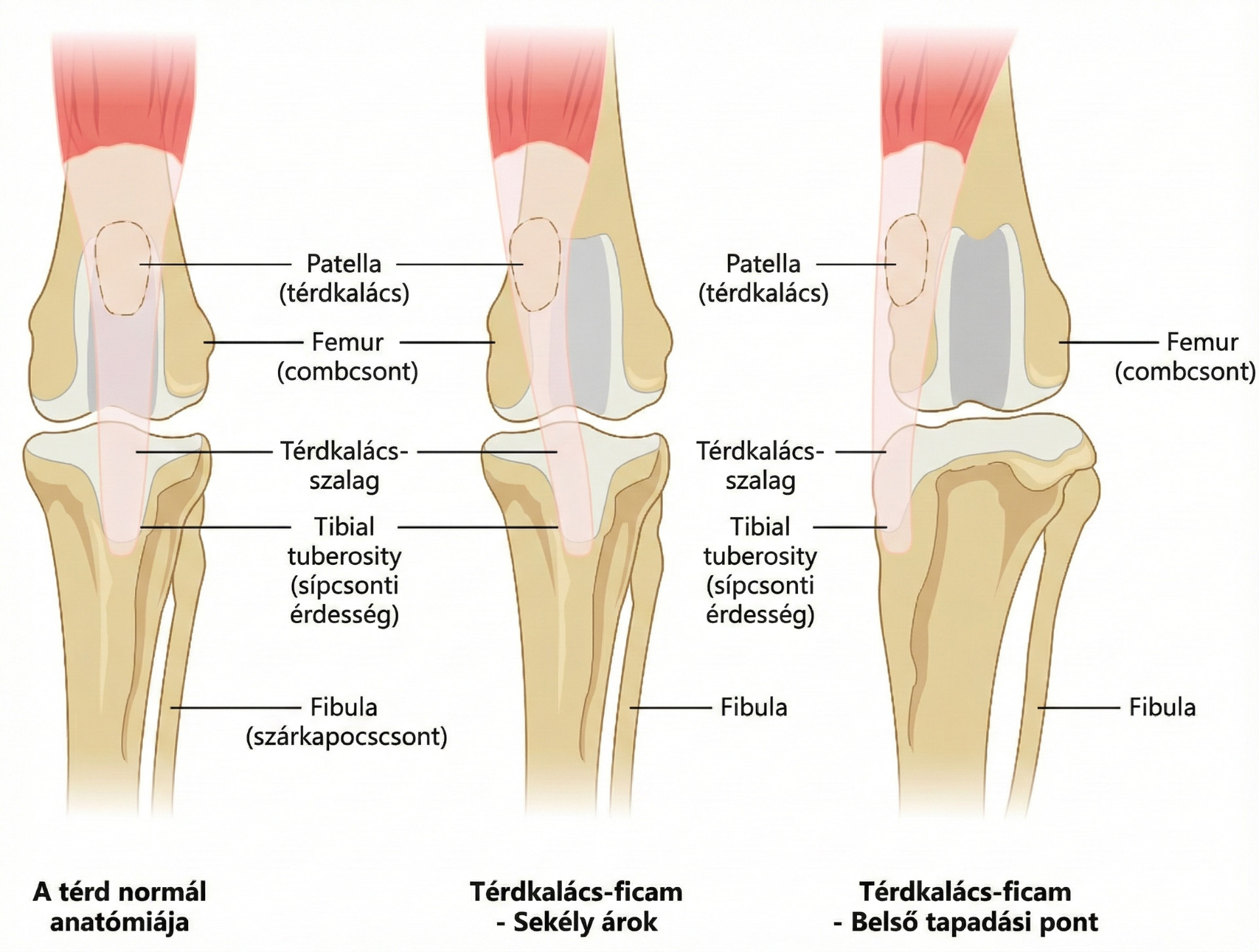 A térd anatómiája